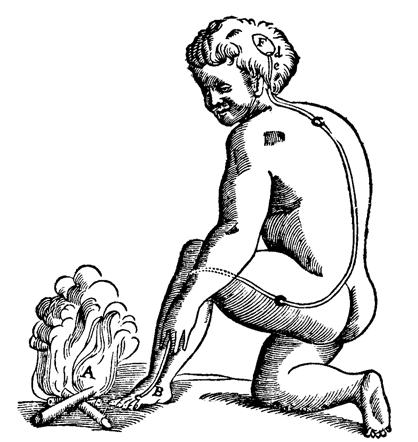 Line drawing of a naked child kneeling by an open fire, labelled A, with a bare foot and hand reaching out to the flames. A line is drawn from the foot (labelled B) along the thigh and up the spine to the brain (final label F).