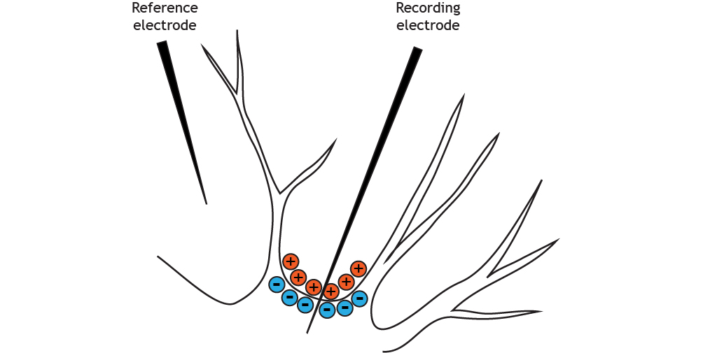 Illustrated section of a neuron cell body shows negatively charged intracellular solution.