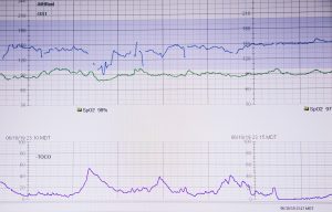 Medical monitor screen displaying multiple graphs and readings. The top section includes two line graphs labeled "MHIRext" and "US1" with y-axis values from 30 to 210. The middle section shows SpO2 levels at 98% and 97%. The bottom section features a TOCO graph tracking uterine contractions over time, with a time range from 06/10/19 23:10 MDT to 06/10/19 23:17 MDT and y-axis values from 0 to 100.